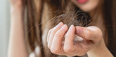 Masz problem z łupieżem i wypadaniem włosów? Sprawdź, jak cynk na włosy może odmie-46835