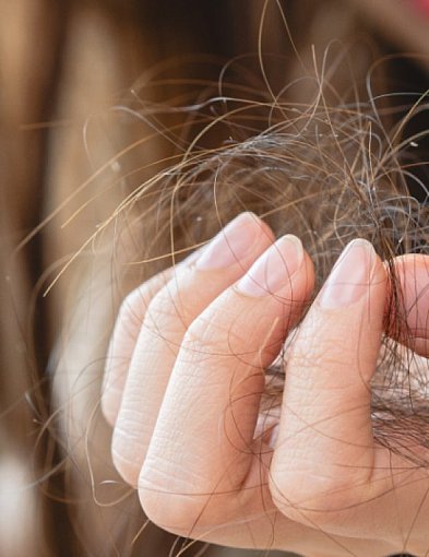 Masz problem z łupieżem i wypadaniem włosów? Sprawdź, jak cynk na włosy może odmie-46835